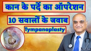 कान के परदे का ऑपरेशन : 10 सवाल । Tympanoplasty | Eardrum hole surgery । Dr Rajive Bhatia। Hindi