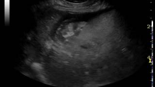 ultrasonography of ruptured gallbladder in a dog