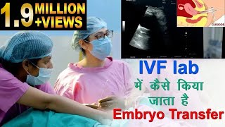 IVF lab में कैसे किया जाता है Embryo transfer | Embryo transfer in IVF lab