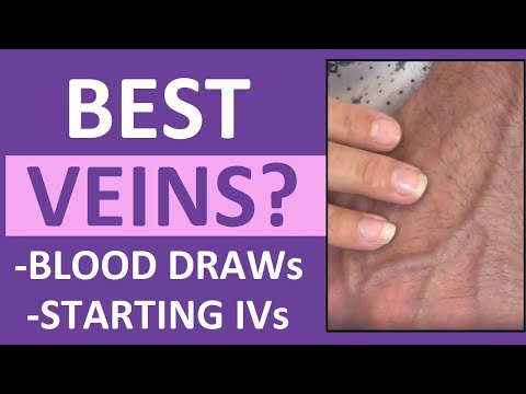 Best Veins For IV Insertion, Drawing Blood (Venipuncture Tips) In ...