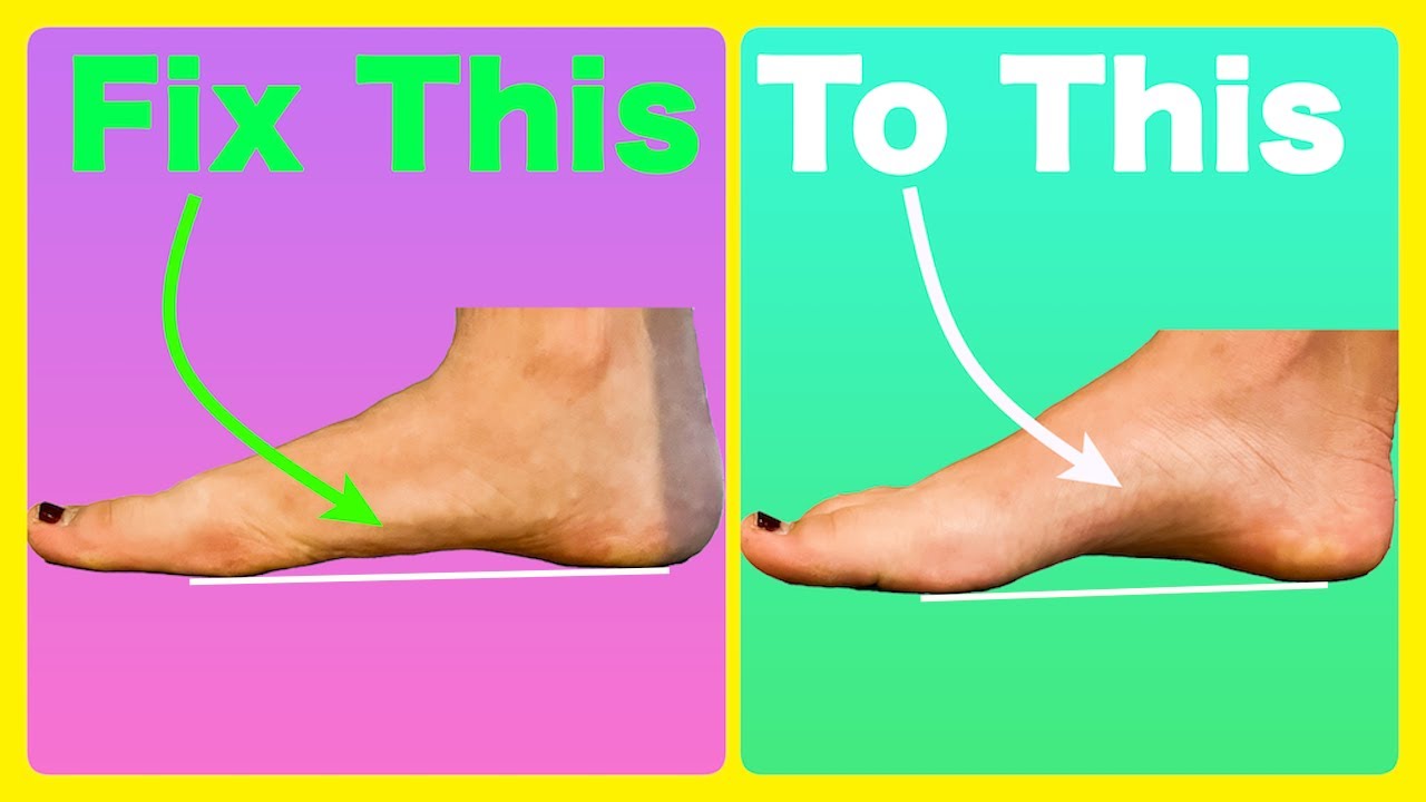 The Flat Foot Fix Youtube
