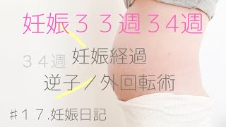 【妊娠日記♯１７】妊娠３３週、３４週の妊娠経過／逆子／外回転術／男の子ママ