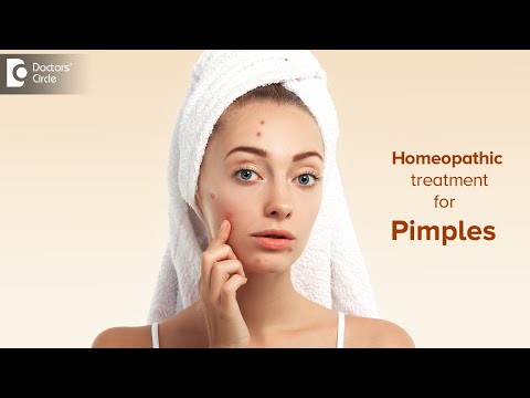 Is homeopathy treatment good for acne?