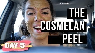 My Cosmelan Peel | Day 5