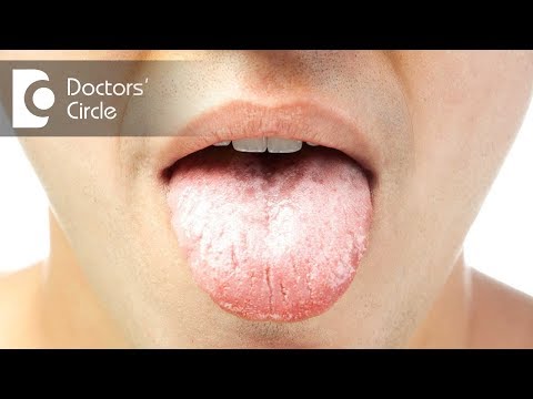 What does a coated tongue indicate?