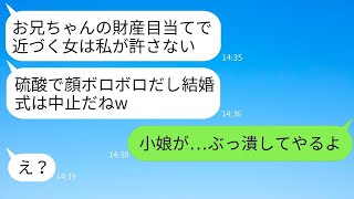 結婚式前日、私を財産目当てと決めた義妹が硫酸をかけて結婚式を中止させた。「兄に近寄るな！」と叫ぶ性悪女に、本気の復讐を遂げた結果www。