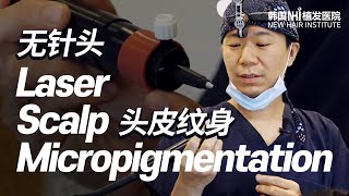 头皮纹身 改善頭頂脫發稀疏  Needleless Laser Scalp Micropigmentation