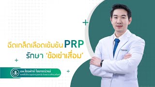 ฉีดเกล็ดเลือดเข้มข้น PRP รักษา ‘ข้อเข่าเสื่อม’