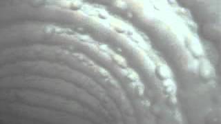 Collapsed swimming pool line video