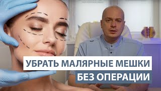 Как убрать малярные мешки без операции