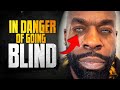 Kali Muscle Going BLIND From DANGEROUS Surgery...