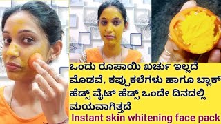 How to Remove Pimpls/ Pimple Marks/Dark Spots/Acne Marks Fast at home in Kannada