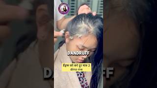 डैंड्रफ को करे दूर मात्र 2 dino में #dandruff