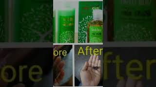 🍃HERB LINE 🍃                    kesha wardhani hair pack 🌷         🌻Order now🌻 whatsapp 0703382335☎️