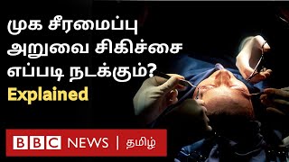 Facial Reconstruction Surgery யாருக்கு கட்டாயம்?  Doctor interview