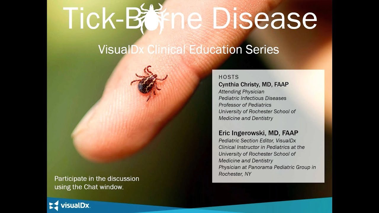 VisualDx Tick Borne Disease Webinar - YouTube