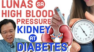 Lunas sa High Blood Pressure, Kidney & Diabetes - Payo ni Doc Willie Ong #907b
