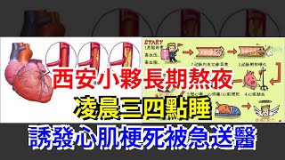 西安小夥長期熬夜凌晨三四點睡，誘發心肌梗死被急送醫，[健康養生之道]