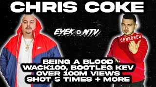 Chris Coke - Being a Blood, Wack100, Bootleg Kev, Over 100m views, Shot 5 Times + More