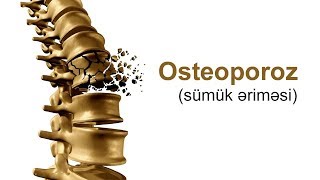 Osteoporoz (sümük əriməsi)