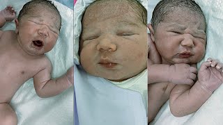 Massive Cutest Huge Size Newborn Baby Beautiful Moment after Birth