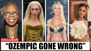 Ozempic Gone Wrong Shocking Celebrity Transformations That Backfired