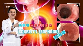 ｜直播｜再聊聊巴瑞特氏食道Barrett's esophagus 的治療｜腸胃霖負擔｜