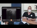 ultrasound examination of the knee