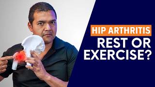What's the Best Way to Help Hip Arthritis?