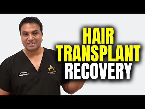 What to expect after a hair transplant?