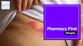 Pharmacy First | Shingles| Pareto Education