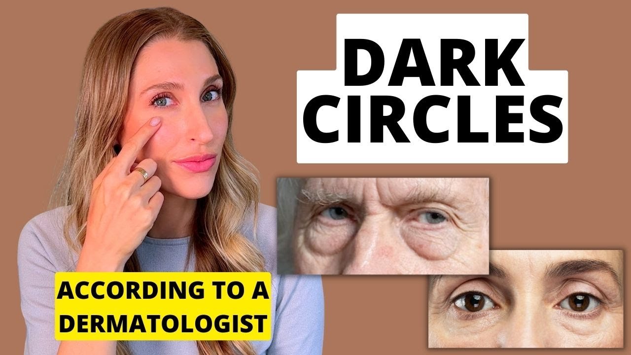 Can You Get Rid Of Dark Circles Under Your Eyes? Dermatologist Explains ...