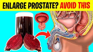 9 Drinks To AVOID With An ENLARGED PROSTATE