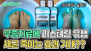 구강청결제 리스테린, 발냄새를 없앤다?! feat. 치과의사가 알려주는 무좀해결 방법