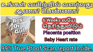 Gender prediction in tamil|கருவிலிருப்பது ஆணா பெண்ணா|How to predict baby gender|boy baby / girl baby