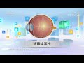 《生活提示》眼睛出现“飞蚊症”怎么办？ 20200707 cctv