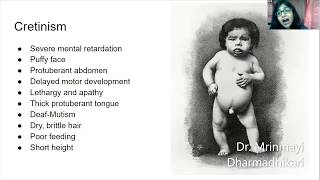 Thyroid Disorders in Pregnancy- A Stitch in Time Saves Nine- By Dr. Mrinmayi Dharmadhikari