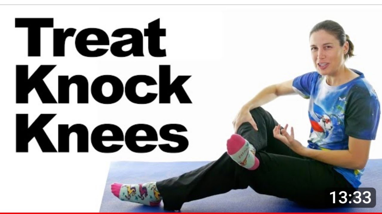 Best Exercise For Knock Knees I How To Fix Knock Knees I Treat Knock ...