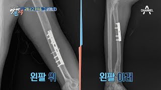 이윤석, 교통사고 후유증, 그 상태는? | 아빠본색