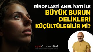 Rinoplasti Ameliyatı İle Büyük Burun Delikleri Küçültülebilir mi? | Doç. Dr. Ozan Luay ABBAS