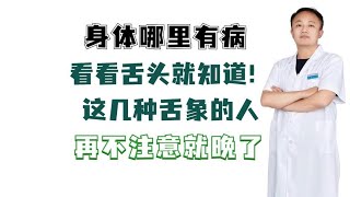 身体哪里有病，看看舌头就知道！这几种舌象的人，一定要注意