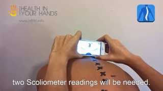 Scoliometer for iPhone and Android Demonstration