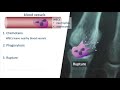 understanding colchicine mechanism study breakdown 【usmle pharmacology】