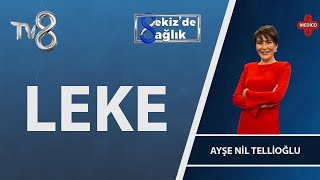 Cilt Lekelerinin Nedenleri ve Çeşitleri Nelerdir? | Ayşe Nil Tellioğlu | 8'de Sağlık