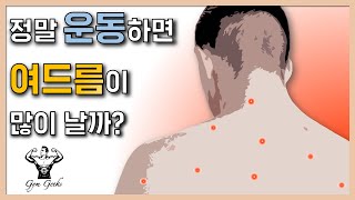 과학적으로 알아보는 운동과 여드름의 상관관계