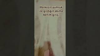 Elim kırıldı