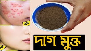 ১০০%কার্যকর।শুধু রাতে একবার লাগিয়েই  দেখুন।দাগ মুক্ত,ফ্রেশ,ফর্সা ও উজ্জ্বল ত্বক হবেই হবে গ্যারান্টি