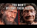 Cavemen had BETTER Teeth than You. Here’s Why.