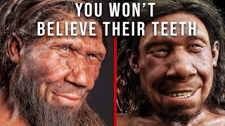 Cavemen had BETTER Teeth than You. Here’s Why.