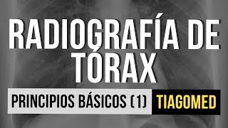 RADIOGRAFÍA DE TÓRAX - Principios básicos (Parte 1)